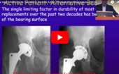 How Much
              Arthritis Is Too Much, Dr. Kris Alden, Chicago Hip Symposium