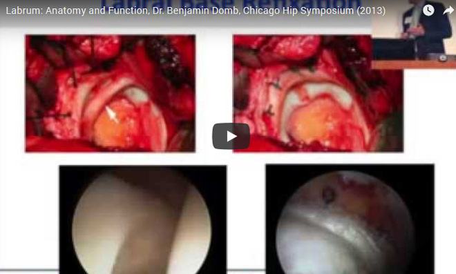 Anatomy and Function, Dr. Benjamin Domb, Chicago Hip Symposium (2013)